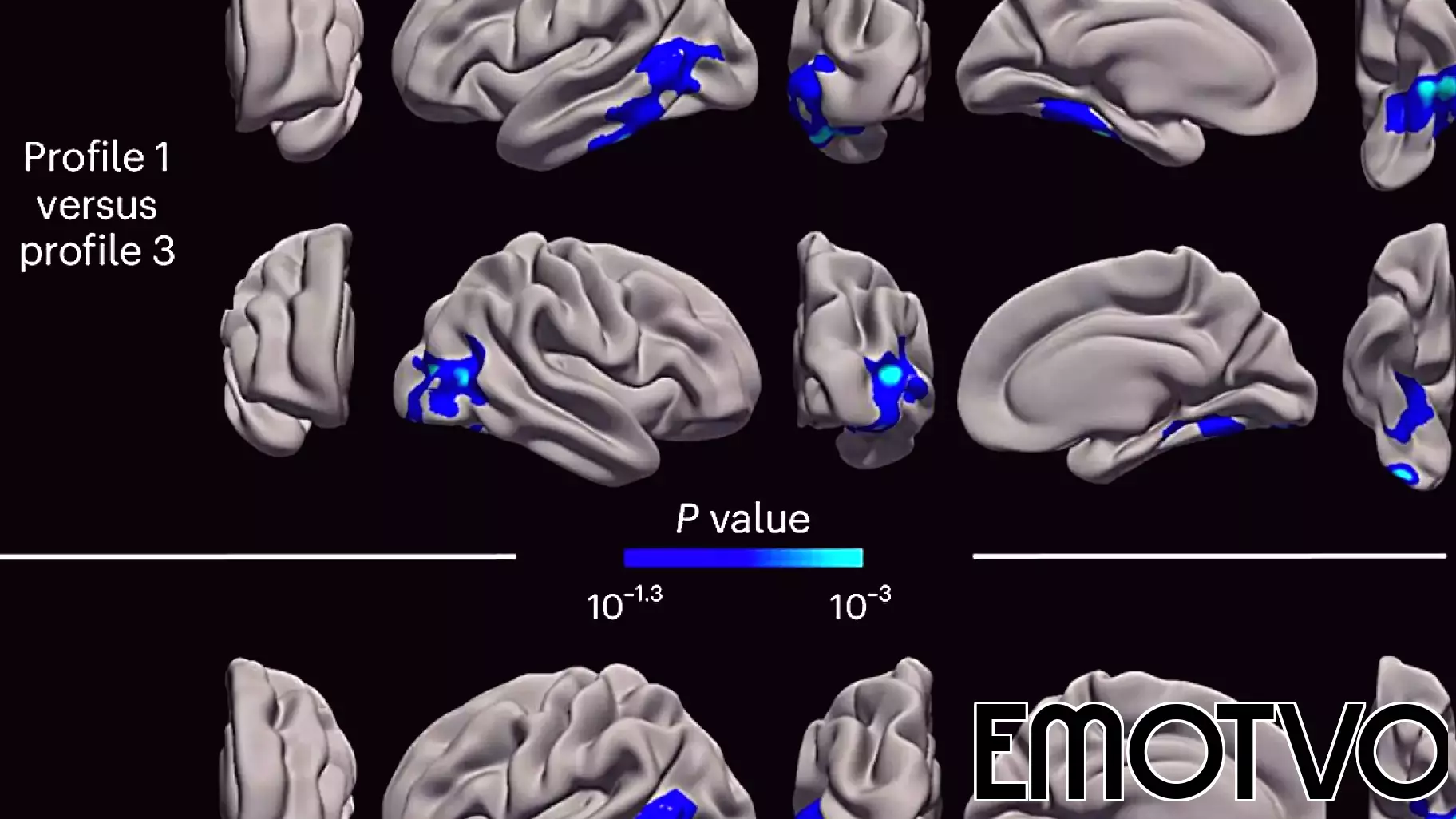 Three Psychological Profiles Linked to Cognitive Decline in Aging